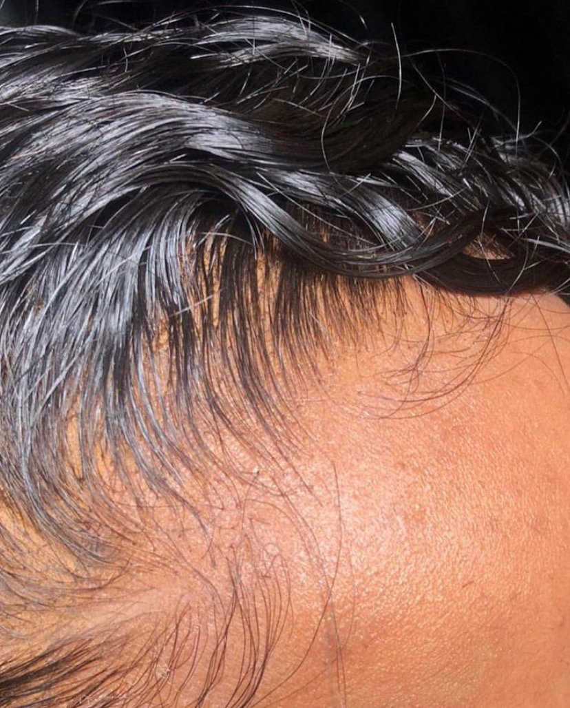 HD Lace Closures and Frontals
